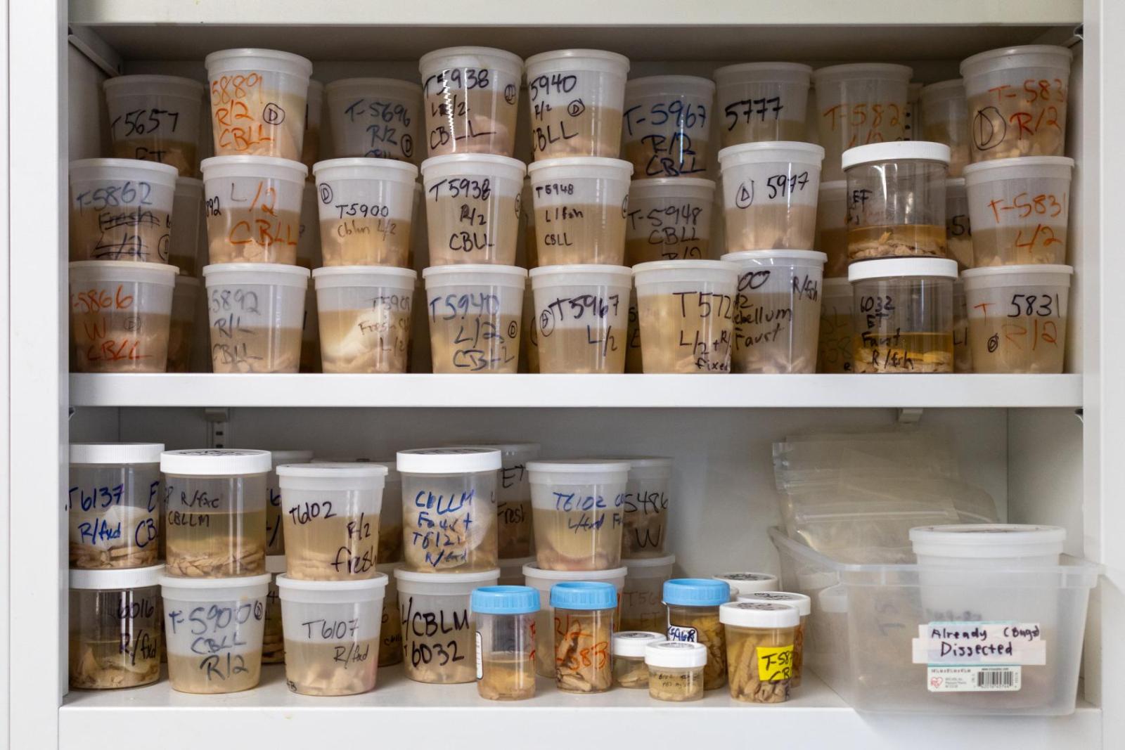 brain samples on a lab shelf